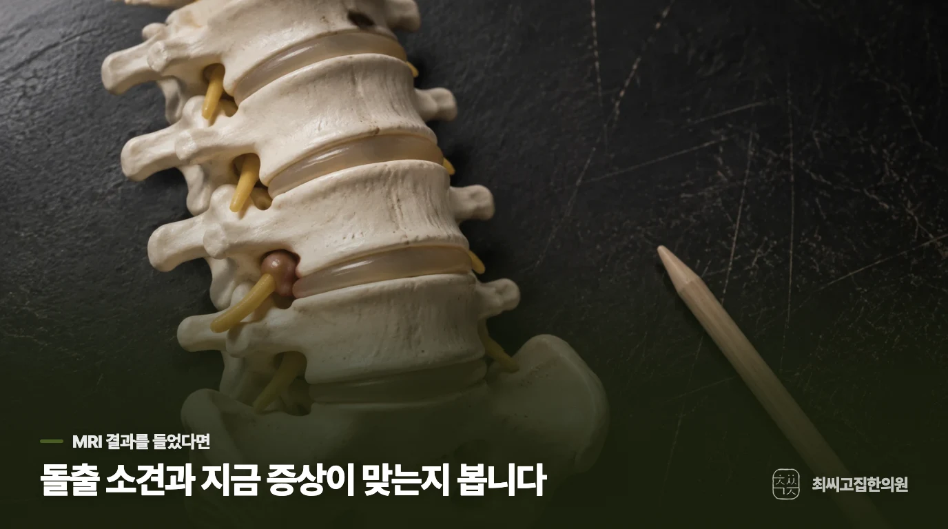 MRI를 보고 나면, 아픈 이유를 찾은 것 같지만