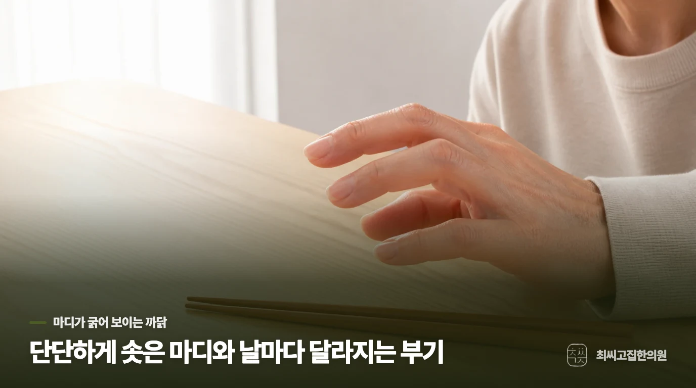 단단하게 솟은 마디와 날마다 달라지는 부기