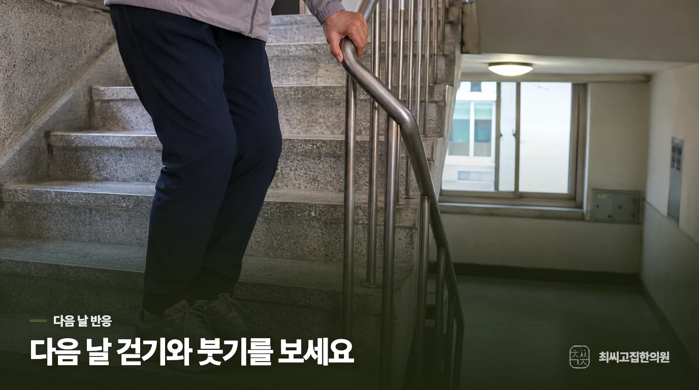 운동 중보다 다음 날 무릎이 더 아픈 이유는 무엇인가요?