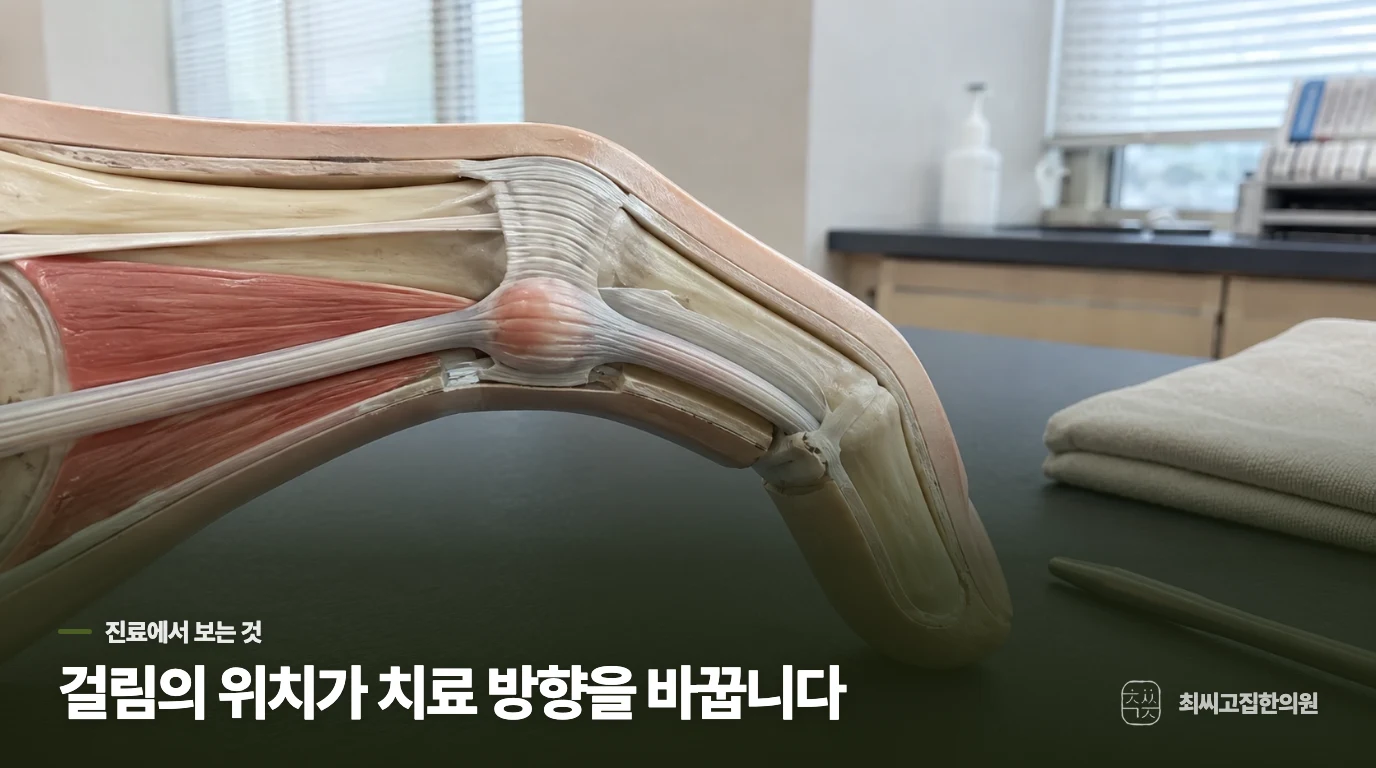 걸림이 계속되면 손가락과 손바닥을 나눠 진료합니다