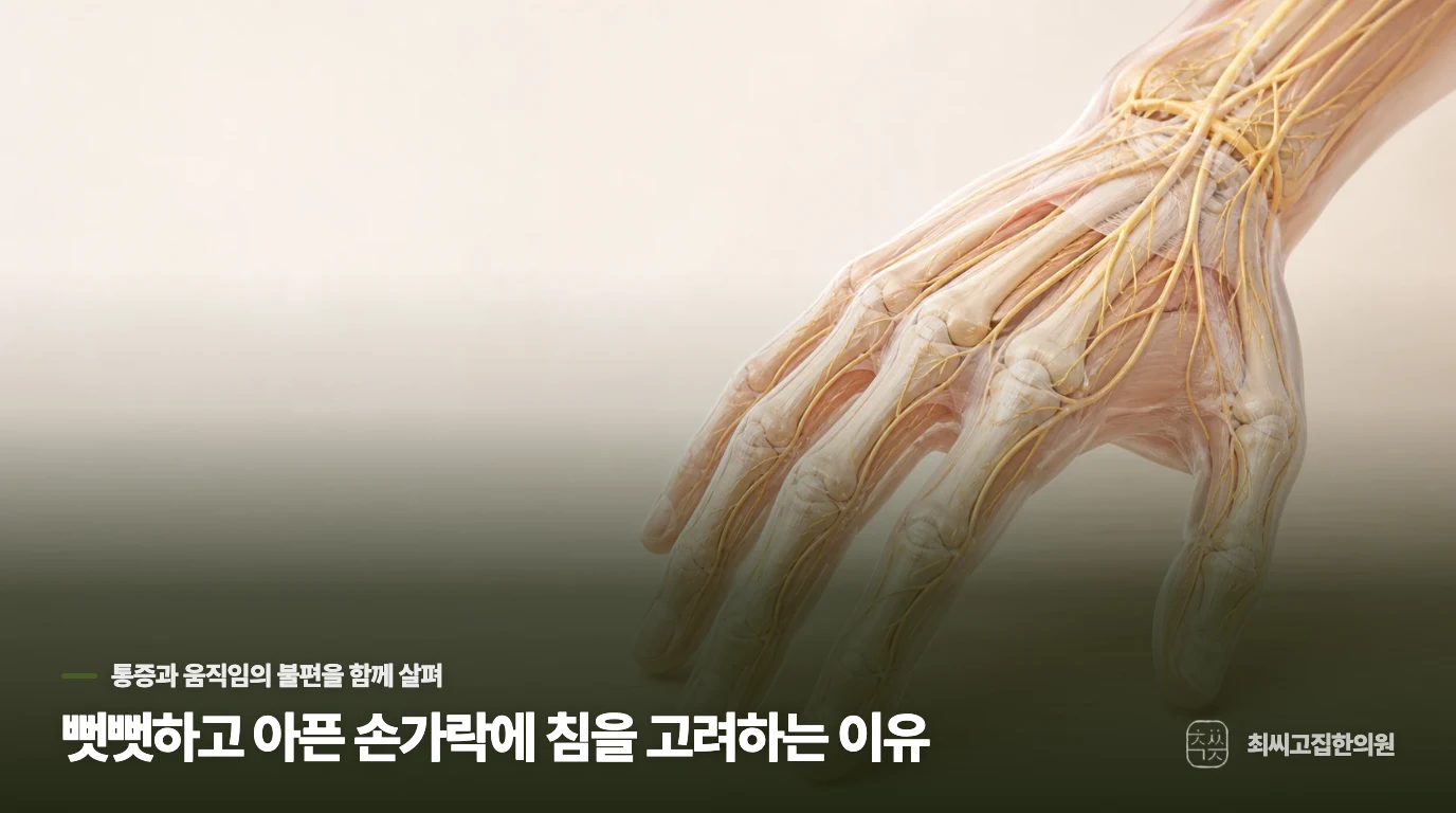 뻣뻣하고 아픈 손가락에 침을 고려하는 이유