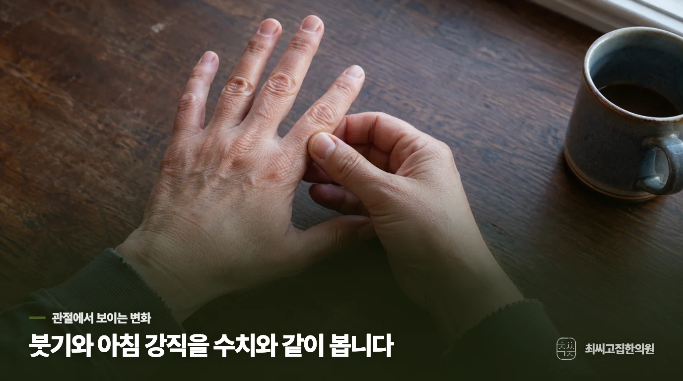 검사 수치보다 관절에서 보이는 변화